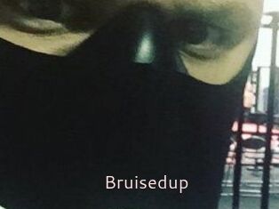 Bruisedup